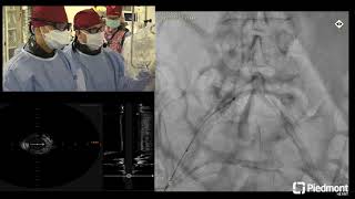 Peripheral Live Case for SCAI Scientific Sessions [upl. by Meehar]