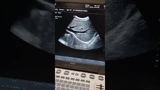 Emperor G30 Best ever notebook ultrasound Color Doppler in best cheap price in pakistan [upl. by Econah385]