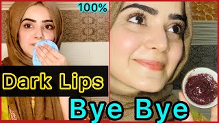 How To Get A Pink Lips Naturally  Remove Pigmentation of Lips 100 Results  Dietitian Aqsa [upl. by Eeramit]