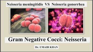 Neisseria I Gram Negative Cocci I Neisseria meningitidis VS Neisseria gonorrhoeae I Bacteriology [upl. by Dorwin]