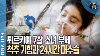 선천적 척추 기형 12시간 장거리 비행 24시간 대수술 마지막 희망을 안고 한국에 온 7살 튀르키예 소녀 부세  현장기록 병원  KBS 20070121 방송 [upl. by Subir]