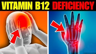 8 Symptoms of Vitamin B12 Deficiency That You MUST Know [upl. by Atsyrhc]