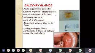 diseases and tumors of the salivary glands [upl. by Ravo]