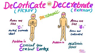 Decorticate Vs Decerebrate RigidityMnemonic for USMLE [upl. by Holladay851]