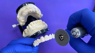 how to make temporary prostheses quickly and cheaply [upl. by Ahsemo335]