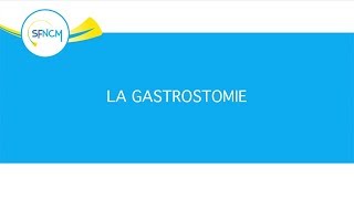 Nutrition entérale  gastrostomie [upl. by Asilrahc599]