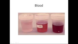 Urinalysis [upl. by Saidee]