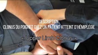 Clonus du poignet chez les patients un atteint d’hémiplégie « Upper Limb Clonus » [upl. by Ihsir]