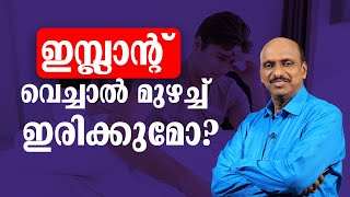 ഇമ്പ്ലാന്റ് വെച്ചാൽ മുഴച്ച് ഇരിക്കുമോ  sexualhealth matters  dr promodu [upl. by Atiuqiram]