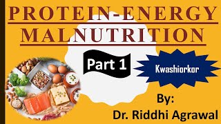 Protein Energy Malnutrition Part 1 KWASHIORKOR NEET 2021 [upl. by Yvon]