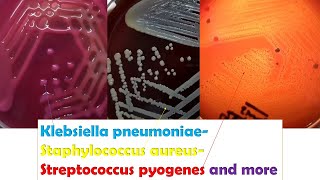 KlebsiellaStaphylococcus Betahaemolytic Streptococci Enterococcus Serratia Micrococcus [upl. by Atinit]