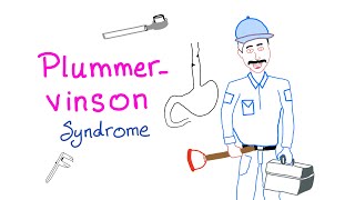 PlummerVinson Syndrome [upl. by Harias]