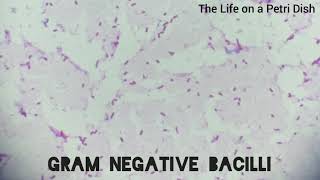 Gram positive cocci Gram negative bacilli and Yeast Cells Under the microscope [upl. by Keisling608]