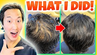 How I Treated My Thinning Hair the Holistic Way [upl. by Kciderf]