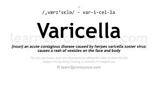 Varicella pronunciation and definition [upl. by Eikkin754]