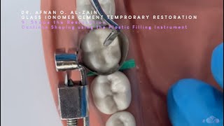 Glass ionomer cement GIC temporary restoration application 1 Fuji IX  Arabic عربي [upl. by Bohner]