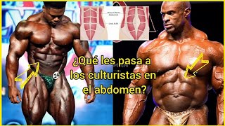 HUECO en EL ABDOMEN CULTURISMO ¿Qué es causas solución Caso Keone Pearson [upl. by Anrahc]