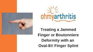 How to Treat a Boutonniere Deformity with an Oval8 Finger Splint  Oh My Arthritis [upl. by Laehpar80]