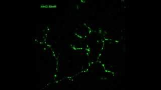 synaptopHluorin in live neurons [upl. by Edyaj818]