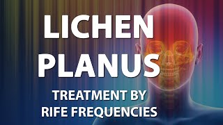 Lichen Planus LP  RIFE Frequencies Treatment  Energy amp Quantum Medicine with Bioresonance [upl. by Yesdnil]