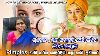 Pimples Treatment  Pimples Sinhala  How to Remove Pimple  කුරුලෑ සුවකරමු  DrPamodani Marasinghe [upl. by Karb]