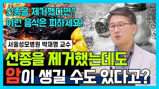 닥터소확행 27화 암의 전 단계 선종 제거해도 암이 생기는 이유는 선종이 발견되었다면 반드시 확인하세요 [upl. by Annaihr]