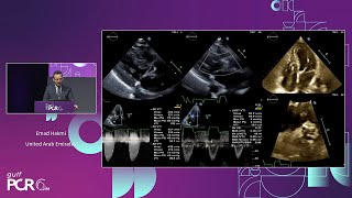 Newer generation selfexpanding platform technical optimisation for common clinical challenges [upl. by Latsyrhk]