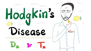 Hodgkin’s Disease  Hodgkin Lymphoma  Diagnosis amp Treatment  Hematology amp Oncology [upl. by Gaskins]