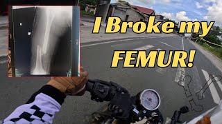 I broke my Femur  Failed Taal Loop  Retro Boys Laguna [upl. by Allit]