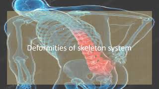 Joints and Deformities of Skeleton Lecture  18 [upl. by Yllut859]