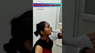 Temporomandibular Joint Dislocation Reduction TMJ By Dr PS [upl. by Idolla31]