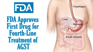 FDA Approves Qinlock ripretinib for FourthLine Treatment of AGST [upl. by Ahsaya]