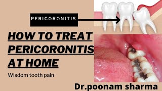 How to Treat Pericoronitis at Home Home Remedies for Pericoronitis [upl. by Vogel]