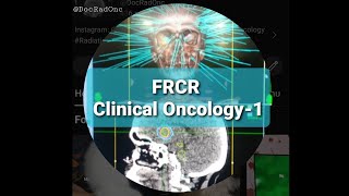 FRCR Clinical Oncology 1 Radiobiology questions Brachytherapy [upl. by Ping]