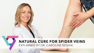 Medical Center Natural Cure for Varicose Veins  Top Vein Expert New York 10016 [upl. by Sivrad467]