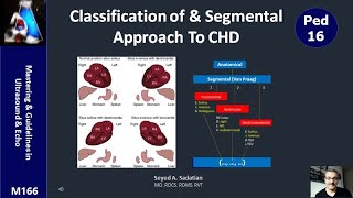 Classification of amp Segmental Approach To Congenital Heart Diseases CHD [upl. by Sykleb]