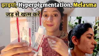 Demelan cream मुश्किल काले धब्बे झाइयां Hyperpigmentation जड़ से खत्म करने का100आसान तरीका [upl. by Eldrid]