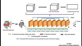 BiS987Biofusion Seminar Deep learningbased beamformer for ultrasound imaging DeepBF [upl. by Dey]