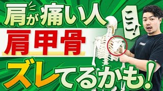 肩甲骨がズレると肩痛は治らない！ズレの原因・改善方法についてトレーナーが解説！ [upl. by Brigham]