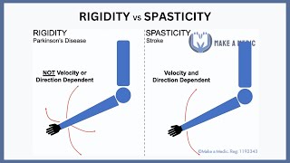 Rigidity vs Spasticity Explained [upl. by Aiva]