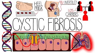 Understanding Cystic Fibrosis Includes Pathophysiology amp Diagnosis [upl. by Luhem493]