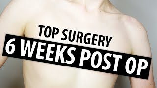 6 Weeks Post Op Dr Garramone  Nonbinary Top Surgery [upl. by Allemaj797]