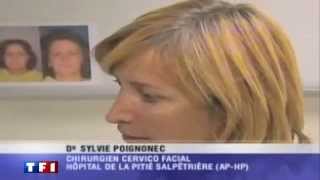 Paralysie faciale  Quels sont les traitements TF1 JT [upl. by Sekyere]