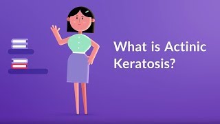 What is Actinic Keratosis Sun Exposure Patches [upl. by Corinna836]