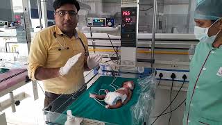 NRP Part8 I Special circumstances I Neonatal Resuscitation I Neonatologist I NICU [upl. by Quartas554]