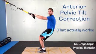 3 Anterior Pelvic Tilt Correction Exercises  Standing Posterior Tilt That Actually Works [upl. by Ardnaeed]