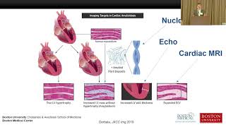 Imaging in ATTR Cardiac Amyloidosis How it is used for Diagnosis and Treatment Response [upl. by Eciruam]