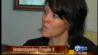 Understanding Fragile X Syndrome [upl. by Noremac]