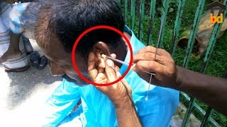 ►WOW  Amazing Street Ear Cleaning in Bangladesh II Incredible Poisonous Ear Wax II Street Life BD [upl. by Agosto]