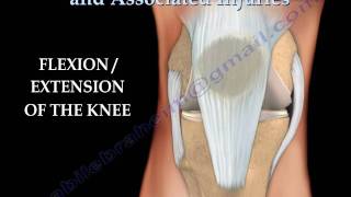 Knee injury Injuries  Everything You Need To Know  Dr Nabil Ebraheim [upl. by Nehte]